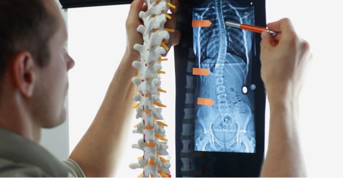 surgeon looking at x-ray