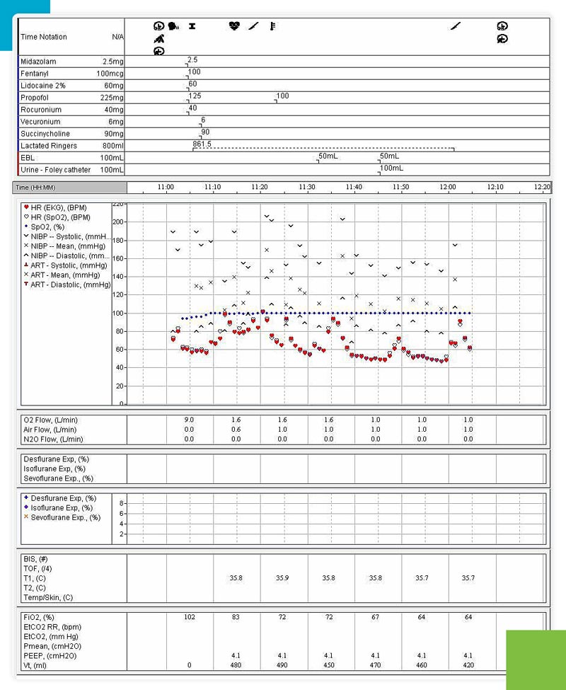 Intraop Chart